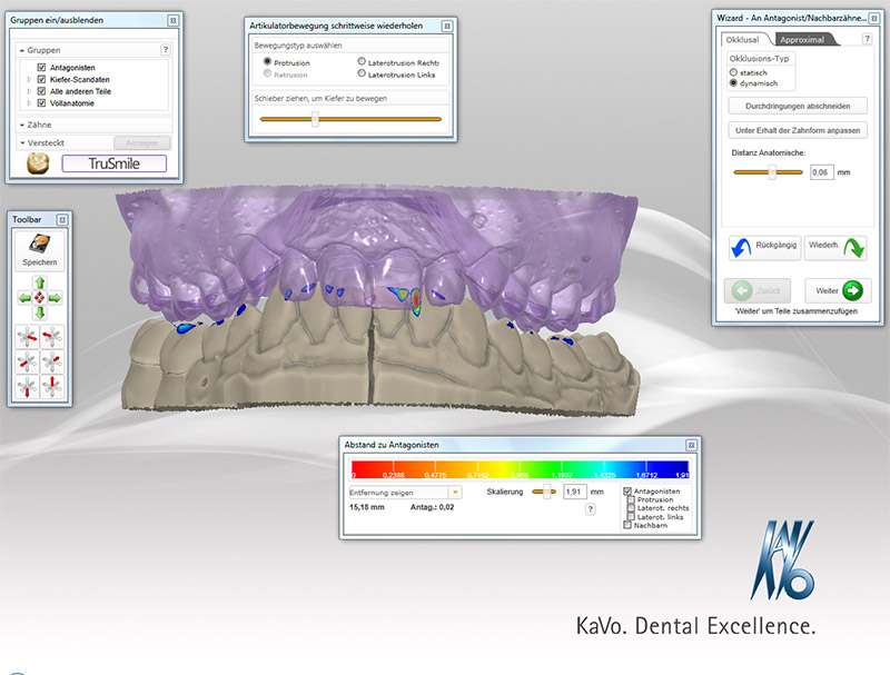 MultiCAD Programi - KaVo MultiCAD- Dentalni CAD Softver Za Vašu ...